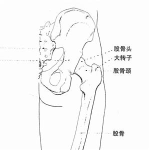 左股骨颈骨折内固定术被鉴定为九级工伤